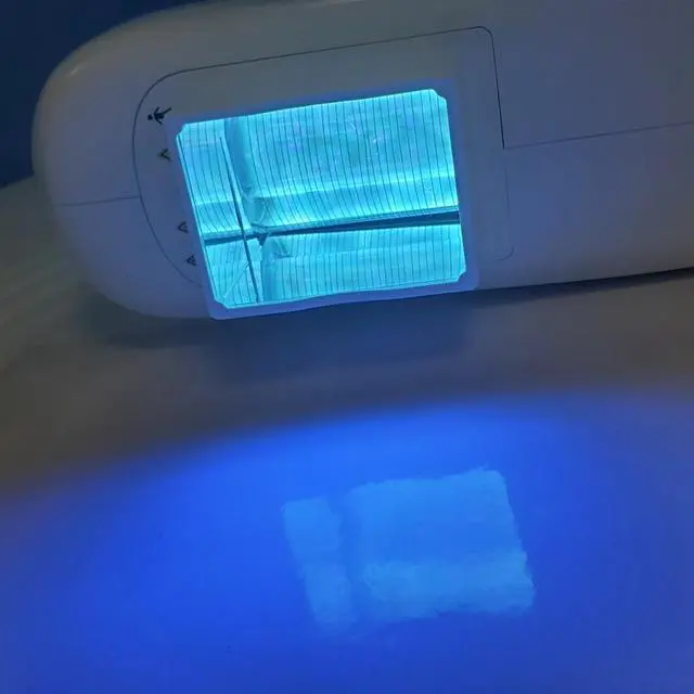 Alt view image 7 of 7 - Kernel KN-5000F high power portable 308 nm Excimer laser for vitiligo psoriasist skin disorders targeted treatment