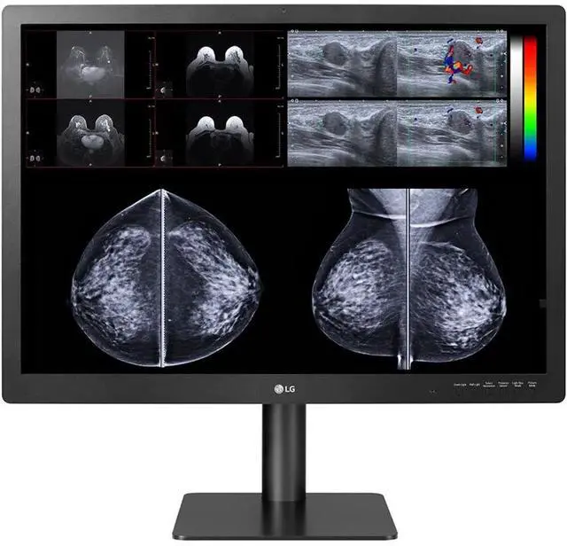 Alt view image 4 of 10 - LG 31in MEDICAL ANTI-GLARE, 3H DIGNOSTIC MONITOR 4200 X 2800 (3:2) CLASS II FDA 510K