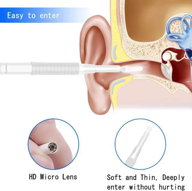Alt view image 4 of 7 - Werleo Ear Otoscope Wireless Ear Endoscope 1.3 Megapixels Wifi Ear Scope Camera USB Ear Cleaning Tool Digital Inspection Camera with 6 Adjustable LEDs for iPhone and Android Smartphone Windows
