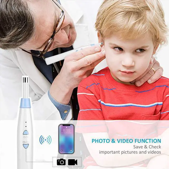 Alt view image 5 of 7 - Wireless Otoscope Werleo 1080P WiFi Ear Scope Camera with 6 LED Lights Digital Ear Wax Remover Tools for Android & iOS Smartphone Tablet