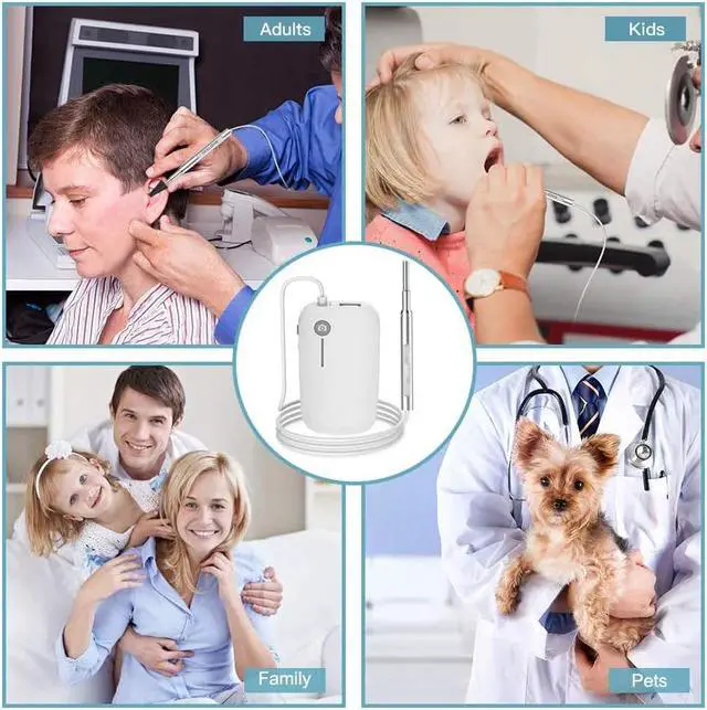 Alt view image 5 of 6 - Otoscope for iPhone, 4.3mm HD Inspection Camera, Ear Microscope, 6 Adjustable LED Lights with Ear Wax Removal Tools, Works with for iPhone, iPad & Android