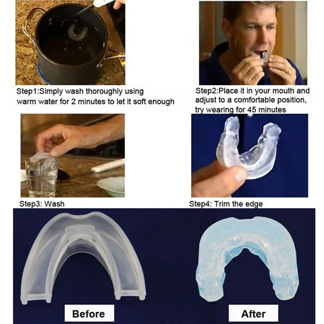 Alt view image 3 of 5 - US 2 Pc Anti-Snoring Mouthpiece Mouth Guard Grind Stop Sleep Apnea Bruxism Aid