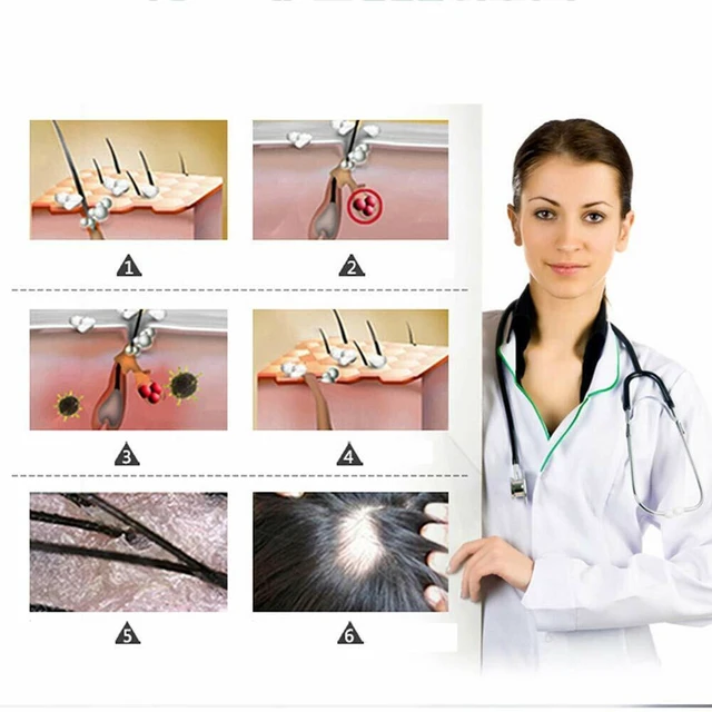 Alt view image 4 of 4 - US 4-8 Pack Ginger Hair Growth Serum Germinal Oil Regrow 7 Days Loss Treatment