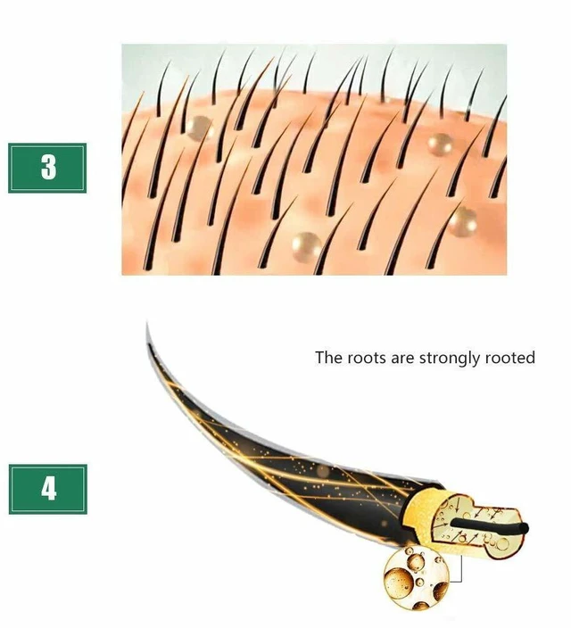 Alt view image 3 of 4 - US 4-8 Pack Ginger Hair Growth Serum Germinal Oil Regrow 7 Days Loss Treatment