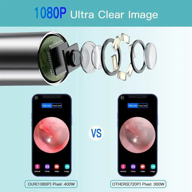 Alt view image 2 of 5 - Ear Wax Removal, Ear Wax Removal Tool, 1080P HD Wireless & Waterproof Ear Wax Remover Endoscope Otoscope with 6 LED Lights, Ear Wax Removal Kit for Kids, Adults & Pets, Great Christmas Gifts