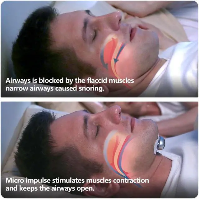 Alt view image 6 of 7 - YA4300 Smart Electrnonic Muscle Stimulator Pro Snore Stopper Throat Breathe Massager