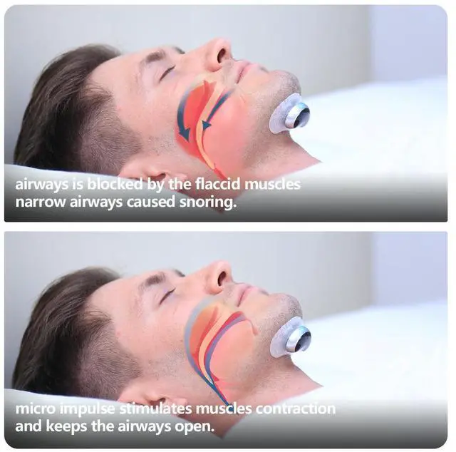 Alt view image 6 of 7 - VVFLY Smart Electronic Muscle Stimulater Pro Snoring Stopper Throat Breathe Massager