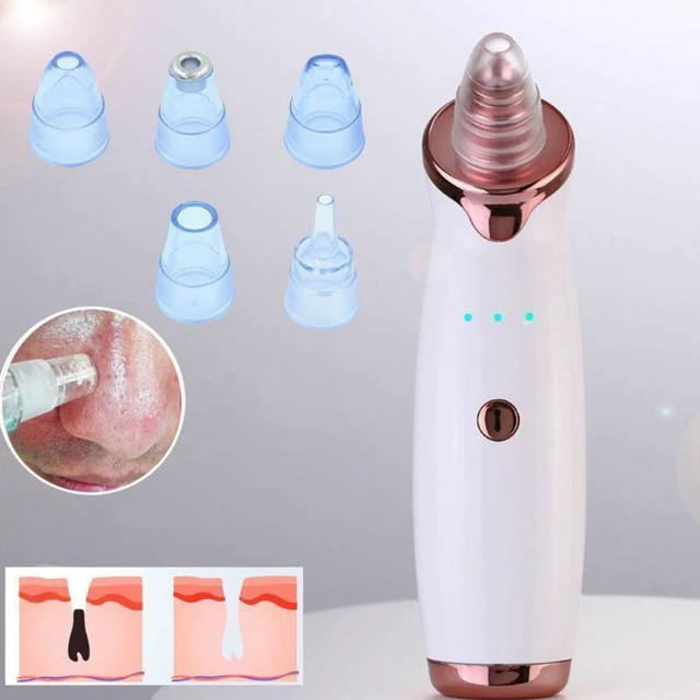 Electric Blackhead Remover Pore Vacuum Suction Face Cleaner+5pcs ...