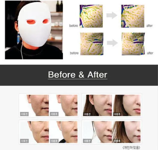 Alt view image 4 of 7 - [SOLLUME ESTHE]Red Light Facial Mask IR Photon Skin Rejuvenation LED Face Mask Beauty Instrument REAL Mask Made in Korea