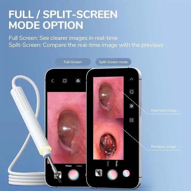 Alt view image 5 of 7 - 3.9mm Ultra-Thin Ear Camera 6 LED Lights,Digital Otoscope Ear Wax Removal Tool