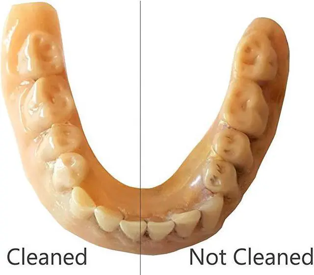 Alt view image 4 of 6 - F3900 Ultrasonic Denture/Aligner/Retainer Cleaner for all dental and sleep apnea appliances, 110V 20W (tank no longer removable) , White , 0.4Pt/0.2L