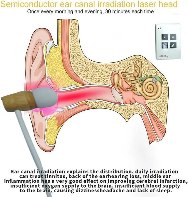 Alt view image 5 of 5 - COZING red light therapy for tinnitus,laser therapy for hear loss