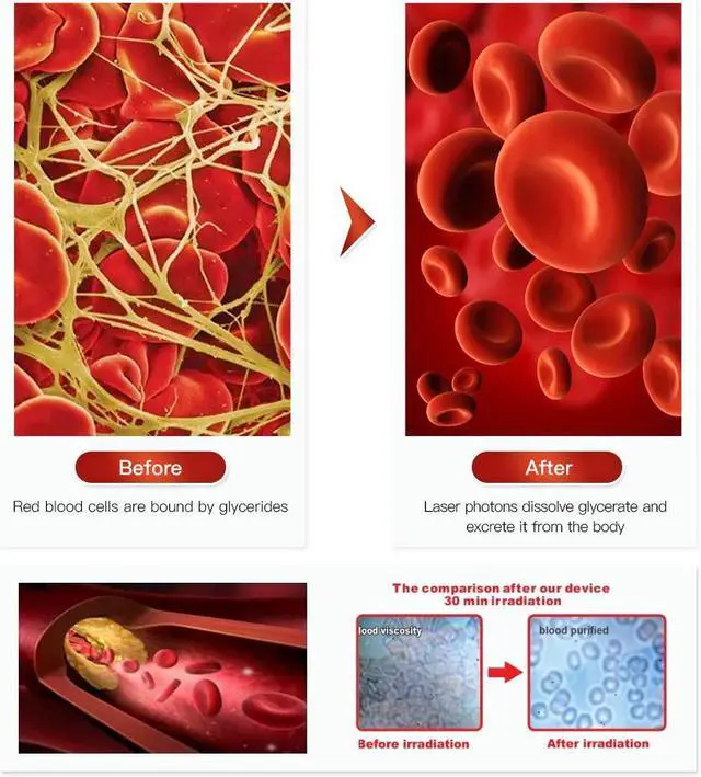Alt view image 4 of 4 - COZING 4 Color Laser Therapy Acupuncture Watch for Sinusitis Sore Tinnitu