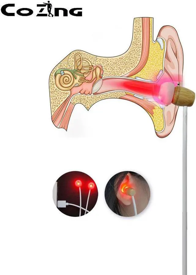 Alt view image 3 of 6 - COZING Tinnitus Ear Laser Therapy LLLT Irradiation Laser Physiotherapy Earplug Otitis Media Deafness Nose Rhinitis Sinusitis Treatment