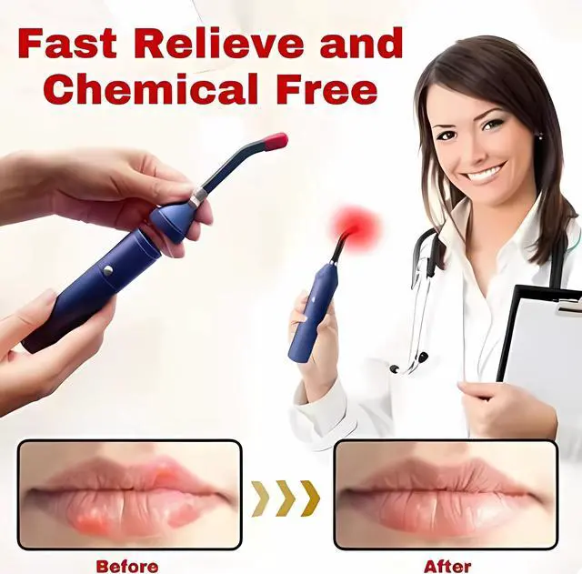 Alt view image 2 of 6 - COZING Red Light Therapy Device, Cold Sore Canker Sore Treatment for Lips, Infrared Light Therapy for Lips Mouth Nose Ear Knee Feet Hands Joint Muscle Nerve Pain Relief with Removable Tip