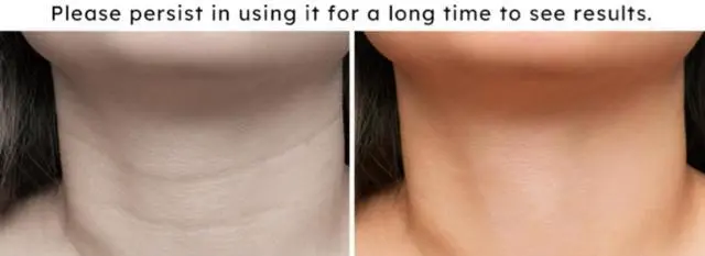 Main image of COZING Neck Beauty Device Red Light Therapy Skin Tone and Texture Enhancement, 660nm and 850nm Dual Wavelengths Emission Device