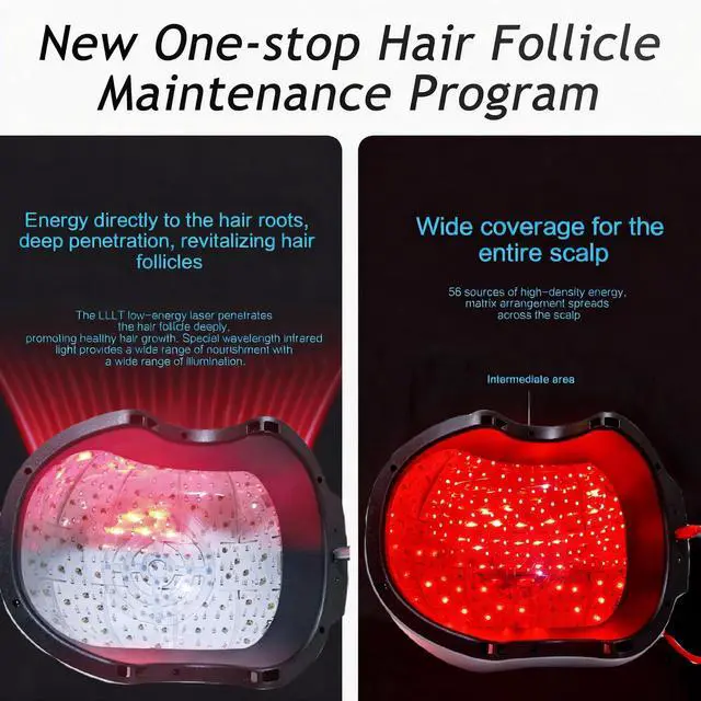 Alt view image 3 of 7 - COZING-C300 Laser Hair Regrowth System 300 Diodes 650nm LLLT Technology with Remote Control for Androgenetic Alopecia Relief