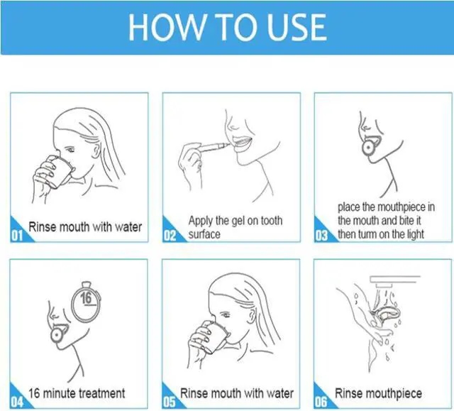 Alt view image 7 of 7 - Teeth Whitening Kit - Professional Tooth Whitening Gel LED Light System,USB chargingand teeth whitening light