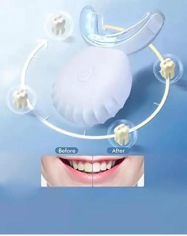 Alt view image 3 of 7 - Teeth Whitening Kit with LED Light and Trays, At Home Whitening Treatments, Vegan Formula with Travel Case