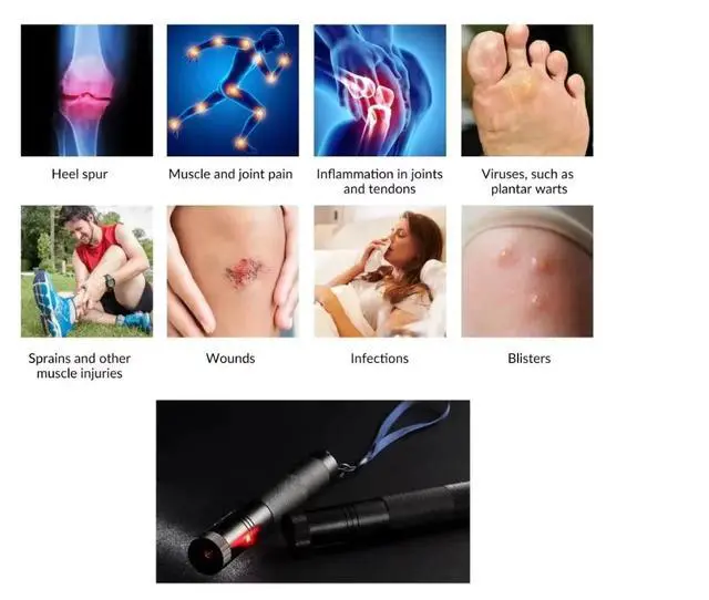 Alt view image 3 of 5 - Rechargeable Laser Pain Relief Acupuncture Pen Electronic Acupuncture Pen Meridians Massage Energy Pen Relief Pain Tools Laser Acupuncture Pen