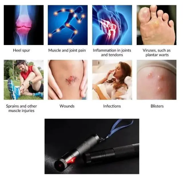 Alt view image 3 of 4 - 200mW 650nm Mini Laser Acupuncture Point Pen Pain Relief Energy Therapy medical Pen