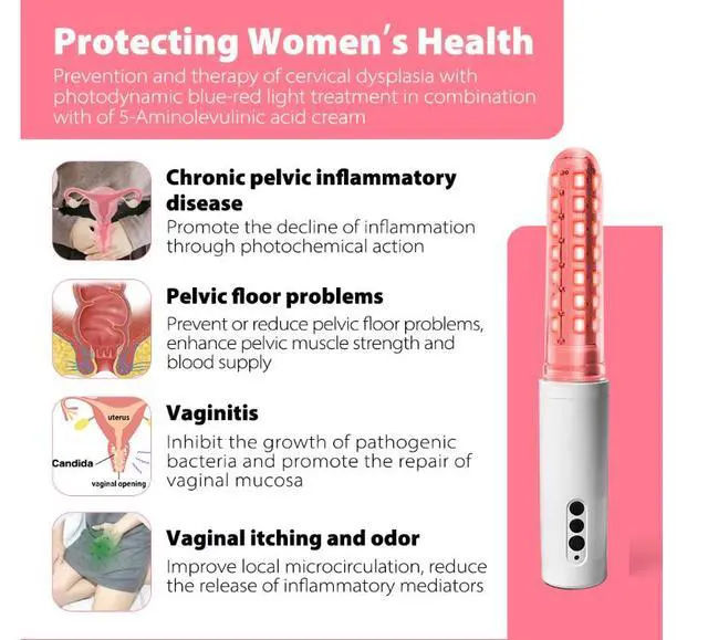 Alt view image 2 of 6 - COZING-W06 Cold Laser Therapy Physiotherapy Device Female Vaginitis Treatment Instrument Female Vaginitis Treatment Instrument