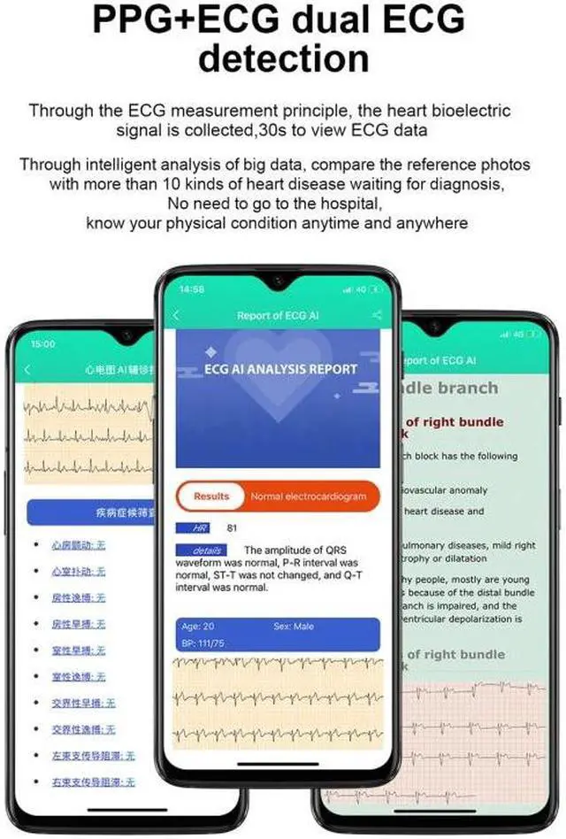 Alt view image 7 of 7 - E86 1.7 inch TFT Color Screen IP68 Waterproof Smart Watch, Support Blood Oxygen Monitoring / Body Temperature Monitoring / AI Medical Diagnosis, Style: TPU Strap TPU Strap(Black) (Black)