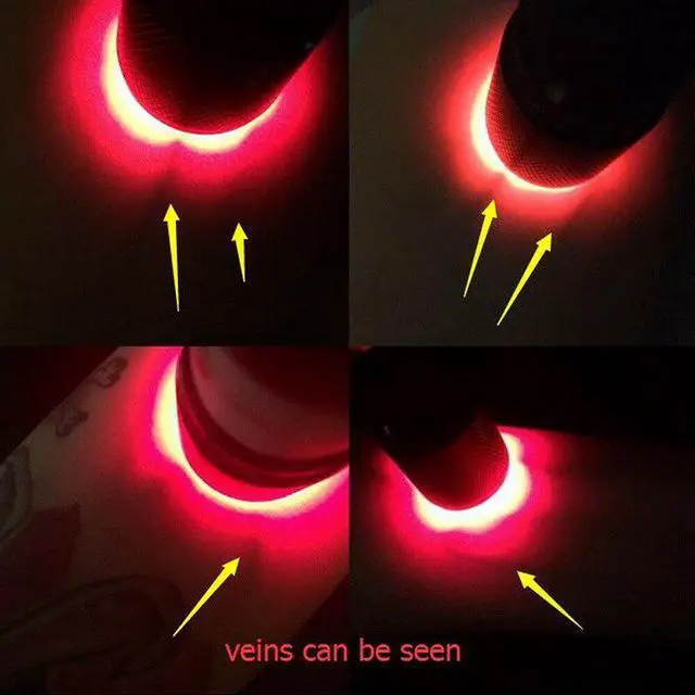 Alt view image 4 of 5 - Red LED Flashlight Vein Finder Tool Transilluminator Vein Viewer TSH Shop