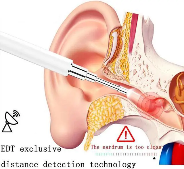 Alt view image 5 of 5 - 3.9mm Ear Endoscope 3 in 1 USB Borescope Inspection Ear Wax Remover HD Camera Visual Earpick Cleaning Tool with 6 Adjustable LED