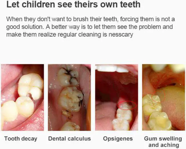 Alt view image 5 of 5 - Wireless Wifi USB Intra Oral Dental Intraoral Camera Dentist Device LED Light Real-time Video Inspection Teeth Tool