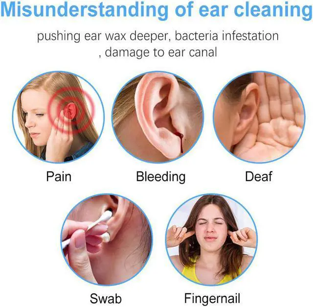 Alt view image 3 of 5 - 3.9 mm Otoscope Camera USB Ear Endoscope Type c Ent Nose Inspect Cameras Wifi Borescope Cam for Adult Child on Android Phone PC