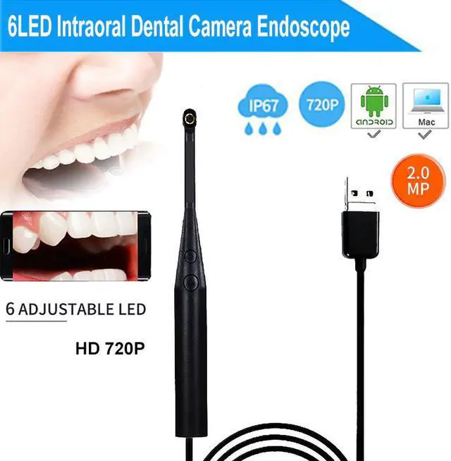 Main image of Camera 720P HD 2MP Intraoral Endoscope 6 LED USB Inspection Oral Real-time Video Inspect Camera Tooth Camera