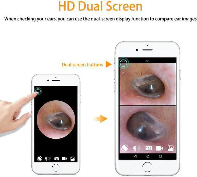 Alt view image 2 of 5 - 3.9mm Wifi Ear Endoscope Camera 1080P Video Otoscope Ear Inspect Camera Borescope Digital Otoscop for ios android Phone