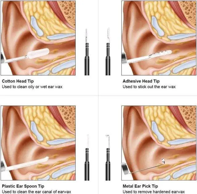 Alt view image 4 of 5 - 3 In 1 Otoscope USB Earpick 1.3MP Endoscope Inspect Camera Wifi Ear Cleaning Tool HD Visual Ear Spoon for Ios Android Phone Pc