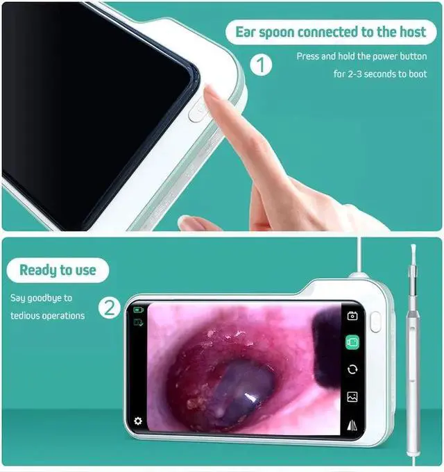 Alt view image 5 of 5 - Digital Otoscope Ear Camera with 5 Inch 1080P HD Screen Ear Scope Otoscopes 3.9mm Inspection Endoscope Ear Wax Removal Tool