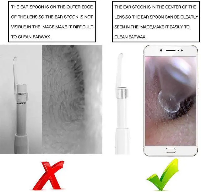 Alt view image 4 of 5 - ear cleaner otoscope ophthalmoscope inspection camera otocopio  usb endoscope ear picker for android and IOS