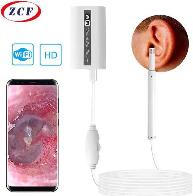 Main image of Wireless WIFI Ear otoscope HD720P Visual Ear picker 5.5mm Mini Inspection Otoscope ear tunnel Camera Android PC IOS