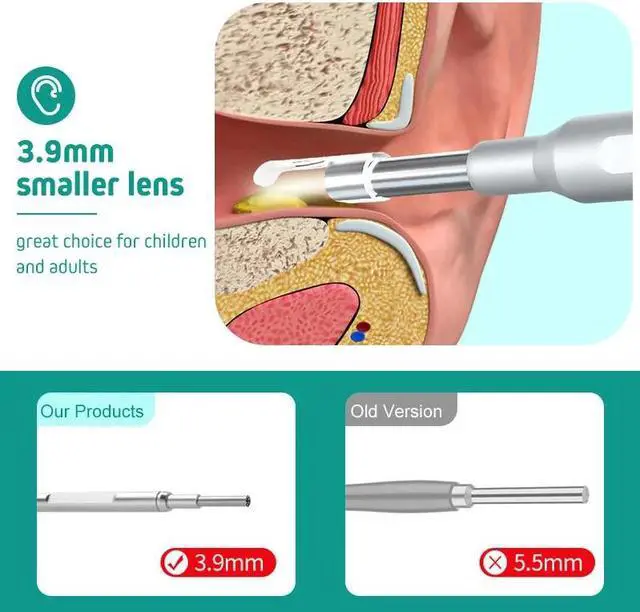 Alt view image 4 of 5 - Digital Otoscope Ear Camera with 5 Inch 1080P HD Screen Ear Scope Otoscopes 3.9mm Inspection Endoscope Ear Wax Removal Tool
