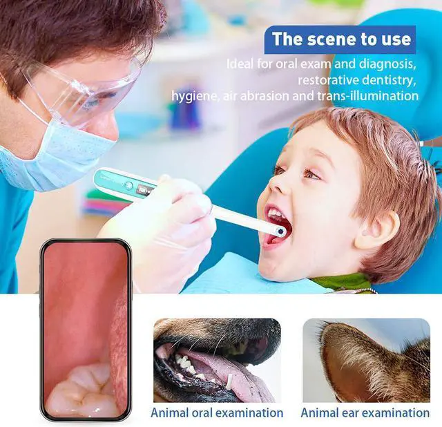 Alt view image 2 of 5 - WiFi Oral Dental Endoscope 8 Adjustable Led Lights Intraoral Camera HD Video for IOS Android Teeth Inspection Endoscope