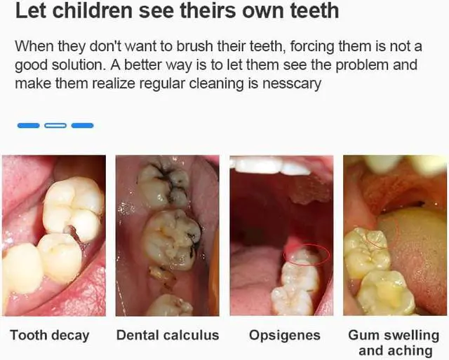 Alt view image 5 of 5 - WiFi USB Intra Oral Dental Intraoral Camera Dentist Device LED Light Real-time Video Inspection Teeth Whitening Tool