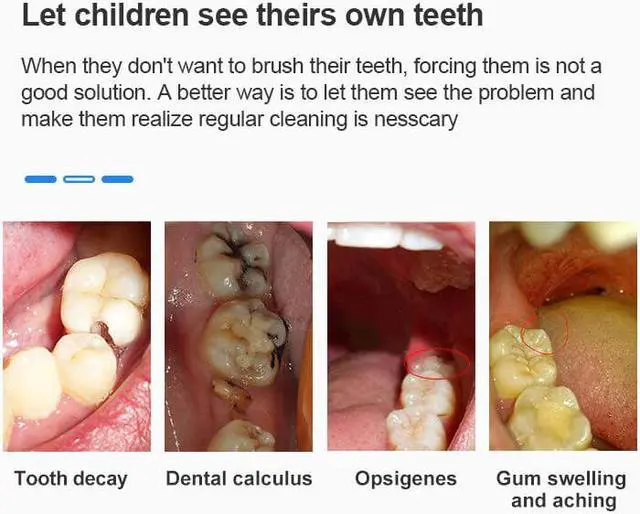 Alt view image 5 of 5 - Dental Intra Camera HD 720P WIFI Endoscope Teeth Mirror Wireless Real-time inspect camera otoscopio tooth camera