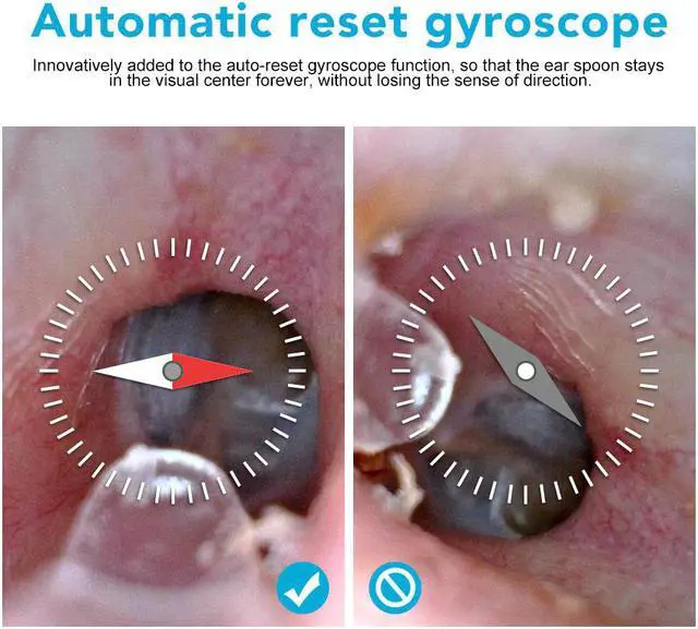 Alt view image 2 of 5 - Ear Endoscope Camera 1080P Video Otoscope Ear Inspect Camera 3.9mm Borescope Digital Otoscop for ios android Phone