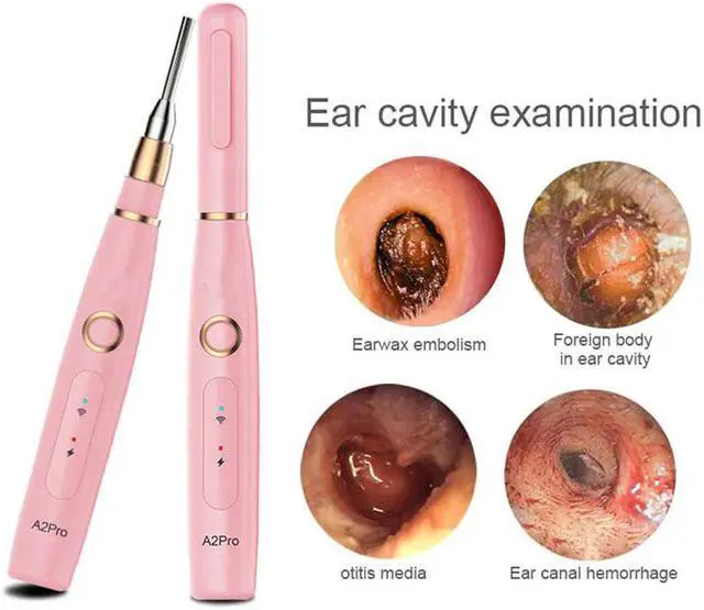 Alt view image 2 of 5 - 1.0MP Wireless Ear Otoscope 3.9mm Lens Waterproof Mini Inspection Camera Borescope Ear Cleaning Endoscope for Mobile Phone