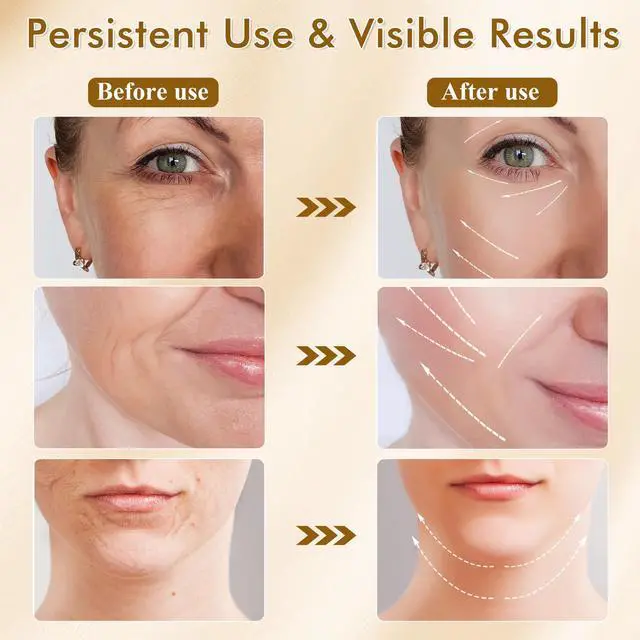 Alt view image 6 of 7 - 7-in-1 Facial Massager with LED Light Therapy, 3 Intensity Levels, 113°F Heating, Deep Cleaning & Skin Rejuvenation for Face and Neck 7 Modes, Rechargeable, Home Use