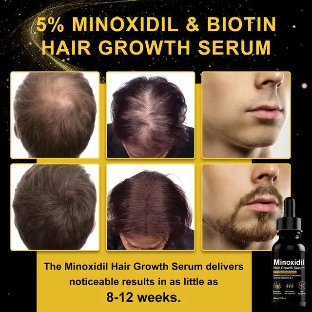 Alt view image 2 of 7 - 5% Minoxidil Topical Solution for Scalp Care, Dropper Applicator, Unscented Formula, Daily Use Hair Care Solution for Men and Women, 6 fl oz(Pack of 3)
