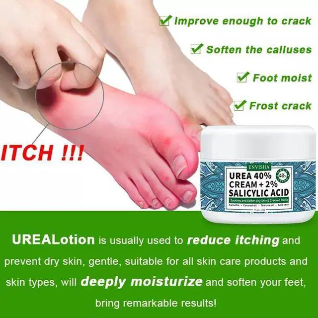 Alt view image 6 of 6 - UREA 40 Cream Antifungal Athletes Foot Cream Jock Itch Ringworm Callus Treatment