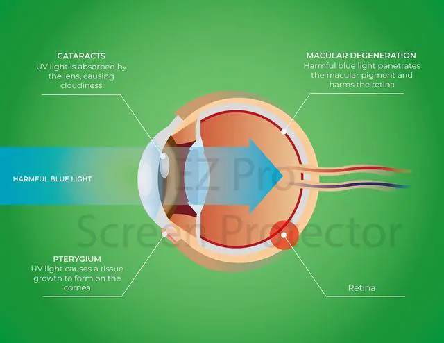 Alt view image 2 of 5 - Premium Anti Blue Light and Anti Glare Screen Protector (3 Pack) for 17 Inches Desktop Monitor with Aspect Ratio 5:4. Filter out Blue Light and relieve computer eye strain to help you sleep better