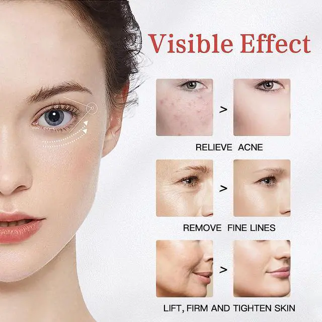 Alt view image 6 of 7 - Gemdeck Face Massager for Face Lift, Facial Roller Device, Multifunctional Skin Care Tools