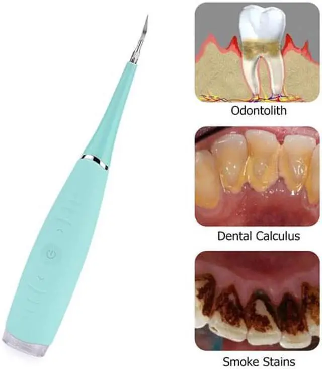 Alt view image 6 of 7 - Electric Sonic Dental Calculus Plaque Remover Tool Kit - Blue - Keep Your Teeth And Gums in Great Shape and Achieve Best Oral Health Care Using This Electric Dental Calculus Remover