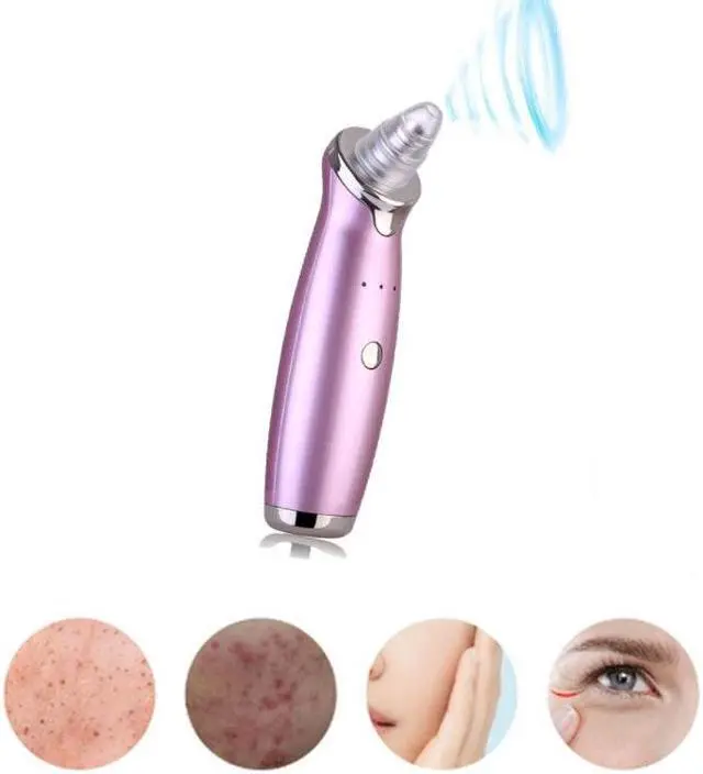Alt view image 5 of 6 - Electric Blackhead Suction Acne Extractor - Rose Red